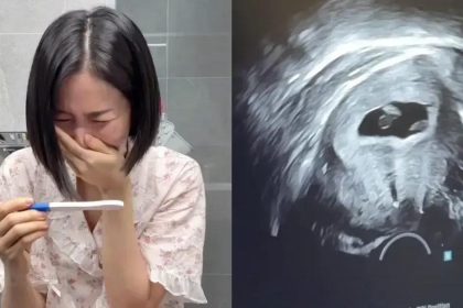 ChoA do Crayon Pop anuncia gravidez após desafios de saúde