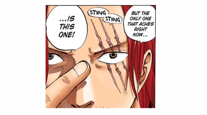 cicatriz do shanks em evidência